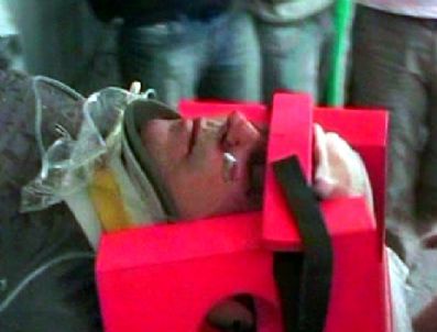 Çanakkale`de Otomobil Şarampole Yuvarlandı: 5 Yaralı