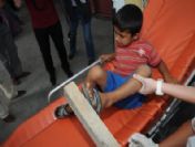 Hastaneye Ayağında Çivili Tahtayla Getirildi