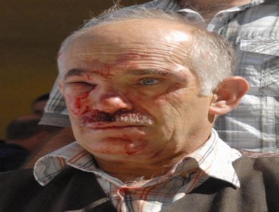 Babalarını Öldüren Gencin Babasını Hastanelik Ettiler