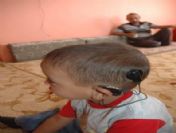 Biyonik Kulağı Çalınan Haşim Senetle Duydu