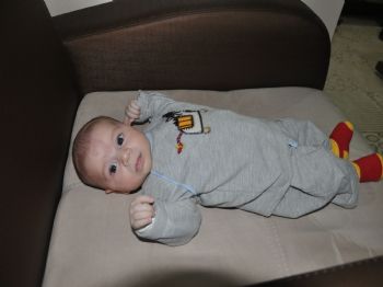 45 Günlük Bebek Anjiyo Oldu