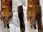 NIL NEHRI - Tıp tarihin İlk Protezleri Bulunmuş Olabilir