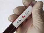 HIV - AIDS'e ucuz test