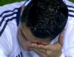 Ronaldo Kan Revan İçinde kaldı, tek gözüyle maça devam etti