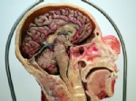 BODY WORLDS - 'Plastine' kadavra ile anatomi dersi