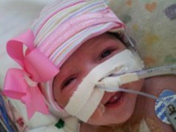 Mucize Bebeğin Ameliyatı Başarılı Geçti