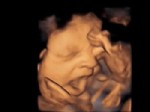 CENİN - Anne karnındaki bebeğin esnemesi görüntülendi