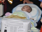 Beyin Kanaması Geçiren 2.5 Aylık Bebek Yoğun Bakıma Alındı