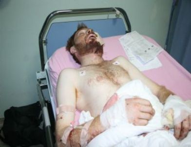 Suriye'deki Çatışmalarda Yaralanan 8 Kişi Kilis'e Getirildi
