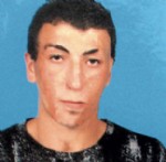 CENGIZ GÜL - İkinci Yüz Nakli De Türkiye'de Gerçekleştirildi