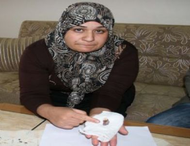 Doktorun, Hastasının Dişi İle Birlikte Çene Kemiğini De Kopardığı İddiası