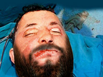 Yüzü artık sakaldan görünmüyor