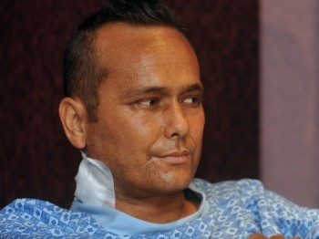 Yeni kollarıyla kameralar karşısında