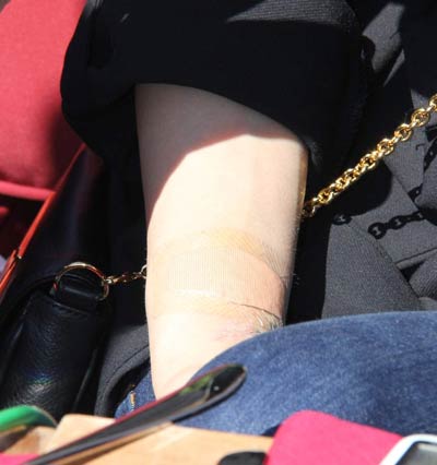 Eski Sevgili Dövmesine Bantlı Önlem