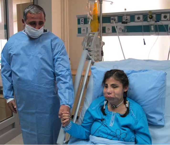 İşte 3. yüz naklinden ilk görüntüler