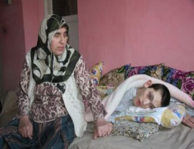 Fedakar Anne 33 Yıldır Sakat Oğluna Bakıyor