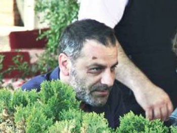 Ozan Güven'in Yara İzinin Sebebi Ne?