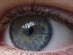 ROMATOID ARTRIT - Göz renginiz cilt hastalığının habercisi mi?
