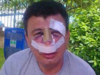 Öğretmene Feci Dayak