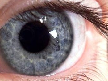 ABD’den 10 bin kornea ithal edilecek