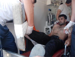 Çivili Kalasla Hastaneye Kaldırıldı