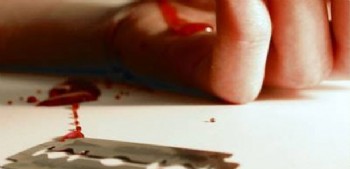 Meclis'in bahçesinde bileğini kesti