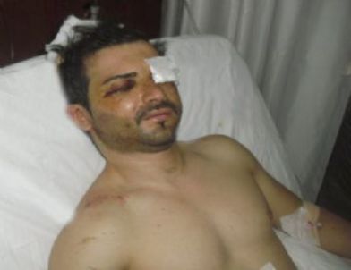 Genç Oyuncuyu Döverek Hastanelik Ettiler