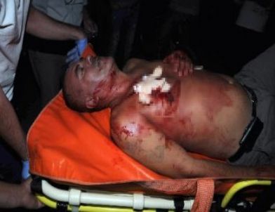 Sigara İstediler, 'Yok' Cevabını Alınca Bıçakladılar