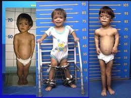 Çocuğunuzun ne kadar uzayacağını hesaplayın