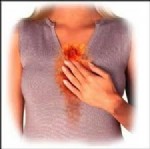 BRÜKSEL LAHANASı - Reflü tedavisine bitkisel destek