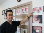 LAZER TEDAVİSİ - Hemoroid 5 Dakikada Tedavi Ediliyor