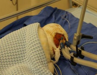 Esed'in Bombaladığı Suriyeliler, Adana'da Şifa Arıyor