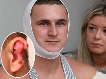 Kulağını bu hale getirdi!