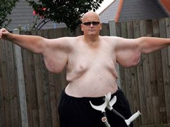 Dünyanın en şişman adamı olmaz denileni başardı