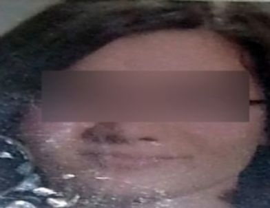 Hırsızlıkla Suçlanan Genç Kız, Öğrenci Yurdunun 5. Katından Atladı