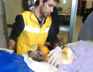 Akçakale Çadırkentte Çıkan Yangında 1 Çocuk Öldü, 5 Kişi Yaralandı