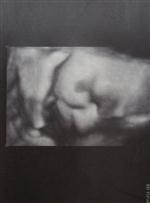 DIŞ GEBELİK - Özel Bingöl Hastanesi, 4 Boyutlu Ultrason Hizmetini Sunmaya Başladı