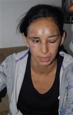 KADIN POLİS - Kendisinden Ayrılmak İsteyen Eşini 3 Gün Boyunca Dövdü