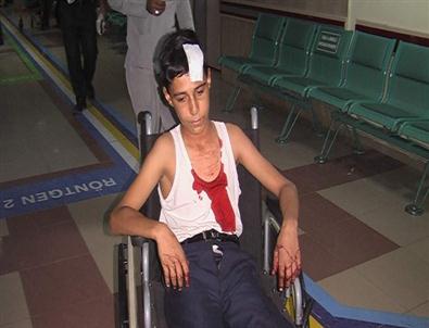 İnşaattan Kafasına Kalıp Tahtası Düşen Çocuk Yaralandı