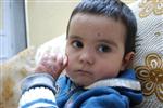 (özel Haber) Vücutlarından Sürekli Kan ve İltihap Akıyor