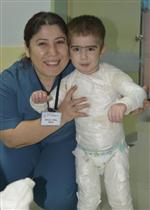 Vücudunun Yüzde 90’ı Yanan 3 Yaşındaki Hakim İyileşti