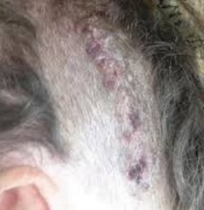 Rock yıldızının beyninden çıkan canlı doktorları bile şoke etti