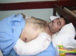 SURİYE ORDUSU - Suriye'den Getirilen 8 Yaralıdan Biri Hayatını Kaybetti