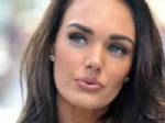 TAMARA ECCLESTONE - Tamara Güzel Yüzüne Ne Yaptı?