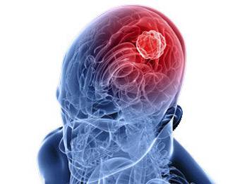 Beynimiz giderek gençleşecek