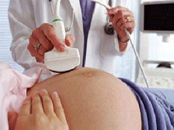 Demir: 'Bir tarama testi yeter'