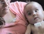 İMPLANT - 3D yazıcı teknolojisi bebeğin hayatını kurtardı