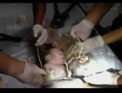 Tuvalete atılan bebeğin inanılmaz kurtuluşu