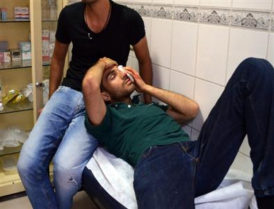 Taksim’de İranlı Gösterici Gözünden Ağır Yaralandı