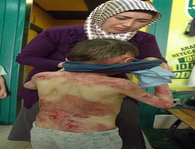 Umut ve Davut Kardeşlere Yurt Dışında Tedavi Yolu Göründü